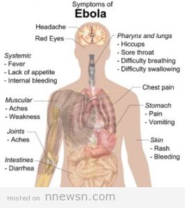 فيروس ايبولا 267x300 ما هو فيروس ايبولا و اعراضه و طرق العلاج منه